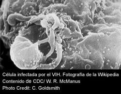 sida vih celula infectada